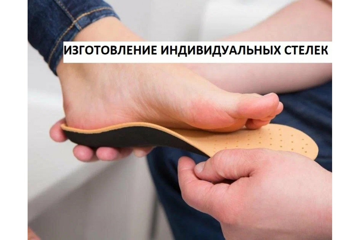 Изготовление индивидуальных стелек